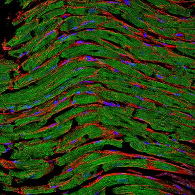 Editorial: Myocardial fibrosis: What we know now